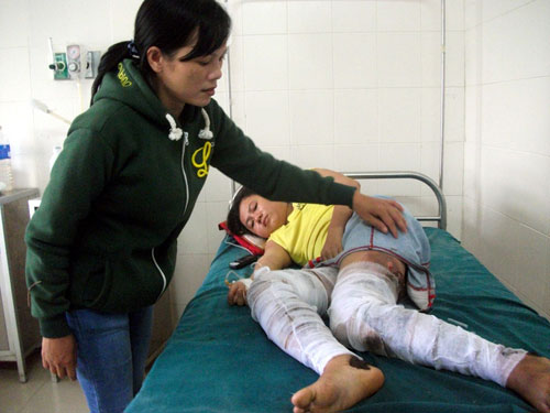 Đốt vợ không nghe lời