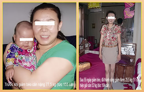 Cùng SPA Ngọc Anh trải nghiệm liệu pháp giảm cân mới bằng châm cứu thế hệ 3 1