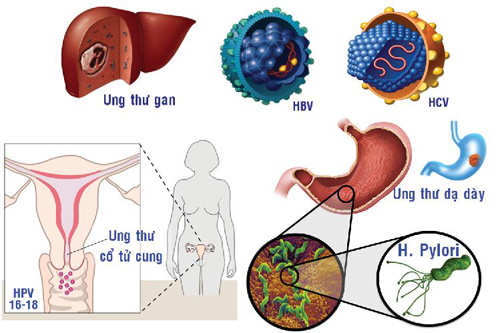 Chiến dịch 'Nói không với bệnh ung thư': Tránh xa những kẻ quấy rối vô hình