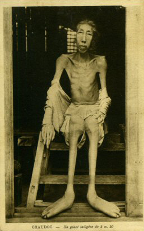 Người khổng lồ d