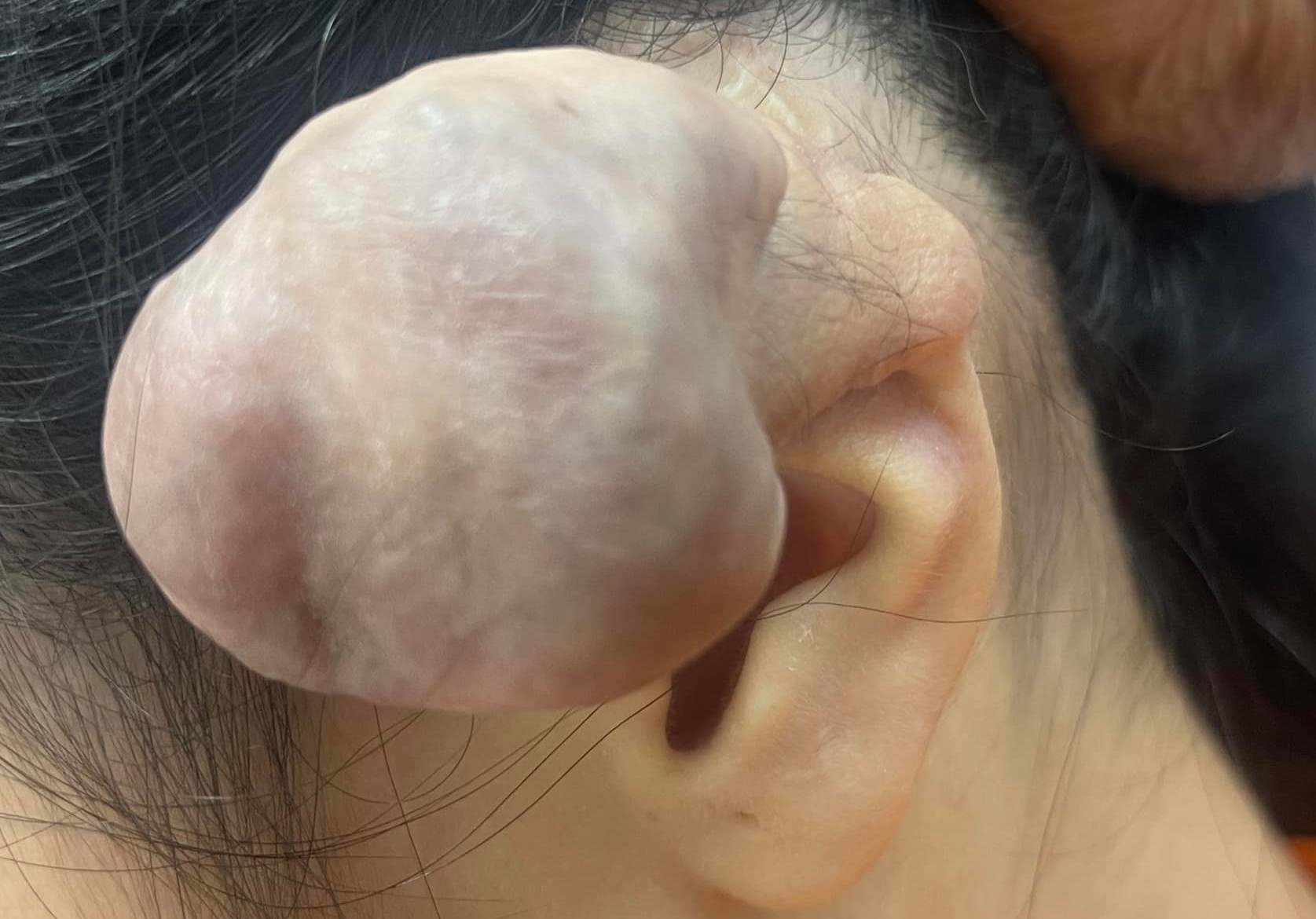 Phương Mỹ Chi bị viêm da khi bấm lỗ tai, những điều này sẽ giúp bạn khắc  phục » Báo Phụ Nữ Việt Nam