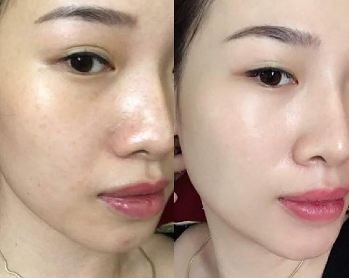 Review kem chống nắng MartiDerm