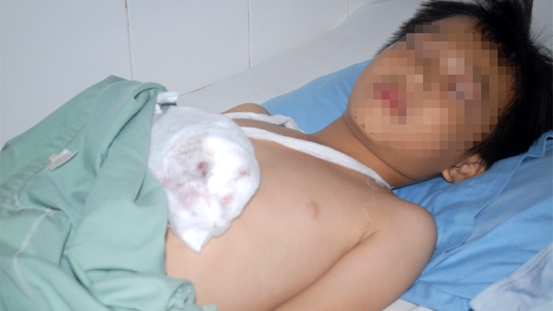 Hoàng Minh Nhật tại khoa Ngoại chấn thương Bệnh viện đa khoa Lâm Đồng - Ảnh: Lâm Viên