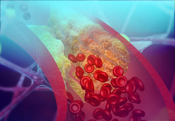 Loại rau có thể làm giảm 40% mức cholesterol 'xấu', 13% nguy cơ đột quỵ - ảnh 1