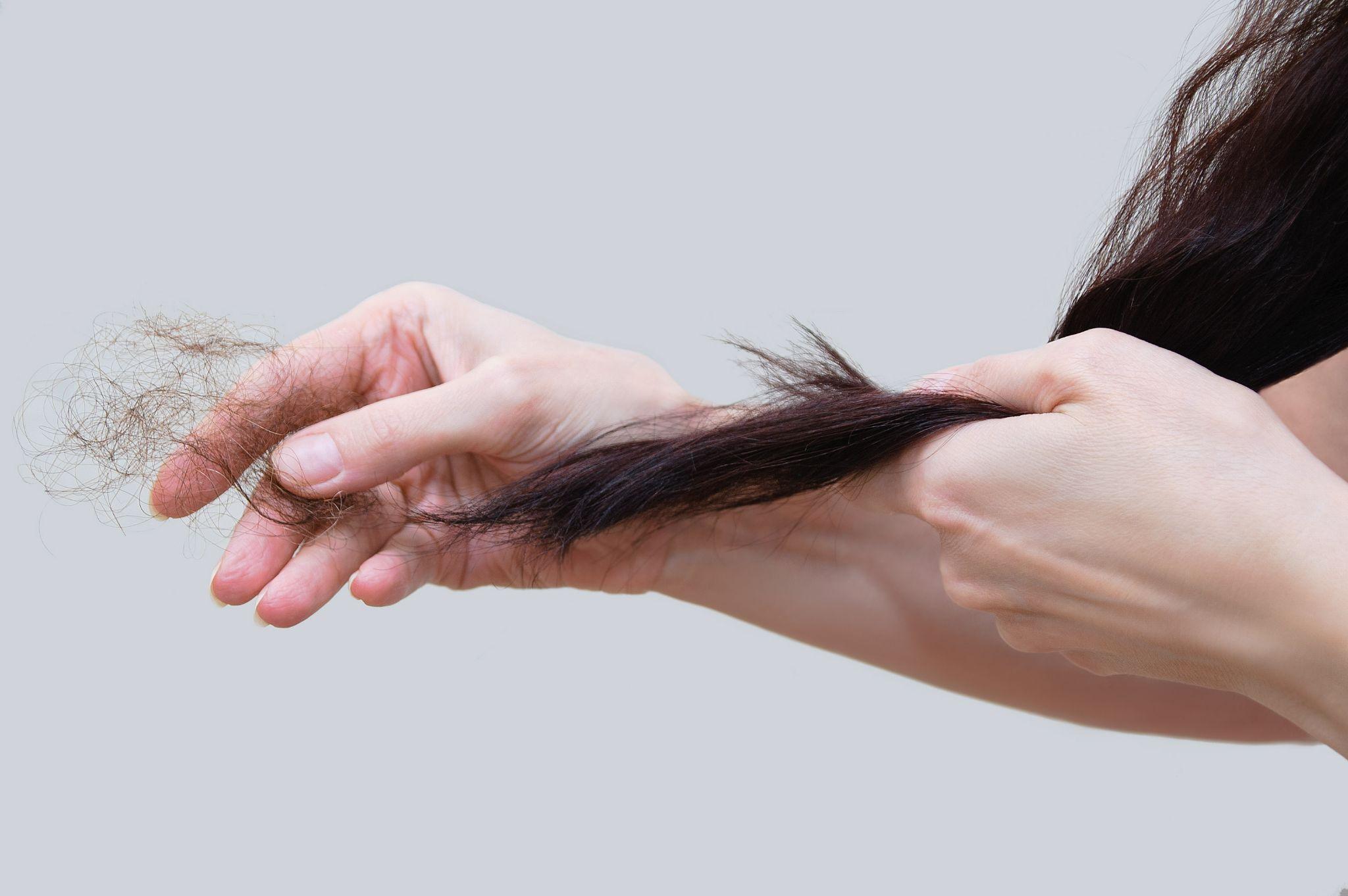 Bổ sung nội tiết tố nữ có giúp giảm rụng tóc sau sinh?