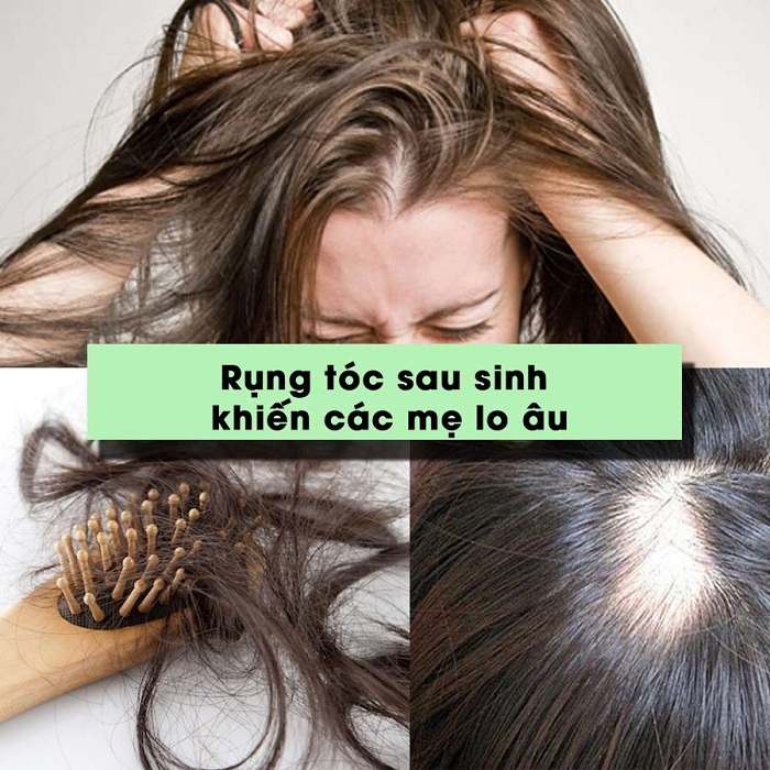 Top 5 cách trị rụng tóc bằng dân gian có thể áp dụng tại nhà