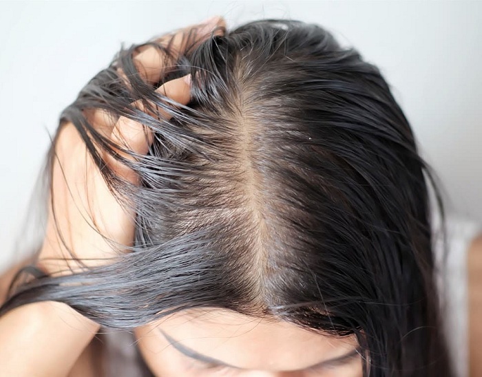 5 cách giúp tạm biệt mái tóc bết dính