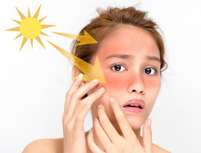 Bảo vệ làn da khỏe đẹp trước tác động của các yếu tố môi trường thế nào?