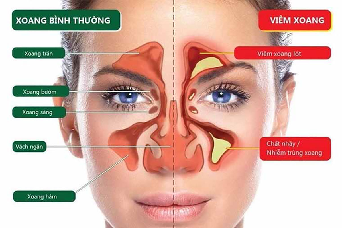 Bác Sĩ Tai Mũi Họng Cầm Thìa Kiểm Tra Cổ Họng Gần Mô Hình Giải Phẫu Khoang  Mũi Và Khoang Miệng Chẩn Đoán Và Điều Trị Các Bệnh Về Tai Mũi Họng