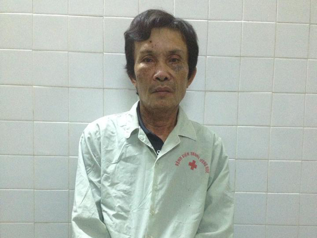 Ông Hồ Đắc Thảo đã bình phục, chuẩn bị xuất viện sau ca sốc phản vệ ngưng tim, ngưng thở nhưng may mắn được cứu sống kịp thời - Ảnh: GS Bùi Đức Phú cung cấp