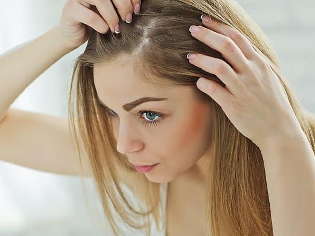 15 phương pháp mọc tóc nhanh trị hói đầu ở nam giới