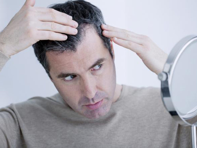 Làm sao để chống lại chứng rụng tóc ở nam giới? | ELLE Man