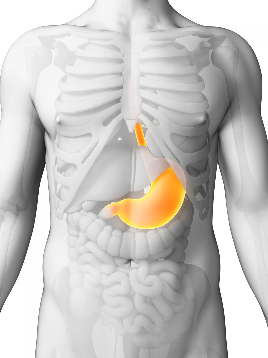 stomach-ulcer-diet281