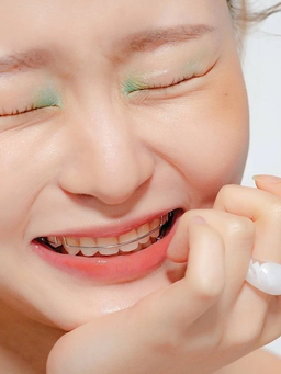 Chăm sóc hàm duy trì sau khi niềng răng hiệu quả nhất từ nha sĩ
