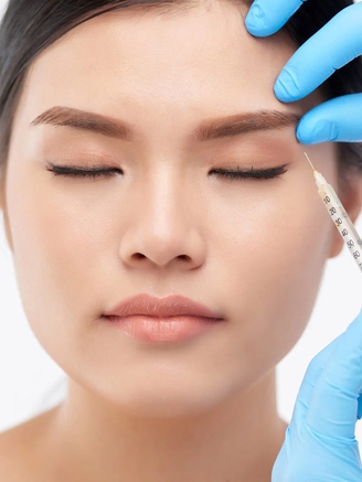 Những vết chân chim ở mắt và điều cần biết khi xóa nếp nhăn bằng botox