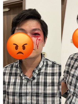 Người cha bị hành hung khi bảo vệ con khỏi chó không rọ mõm ở TP.HCM: Góc nhìn luật sư
