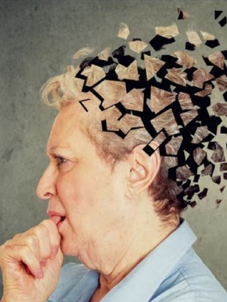 ChatGPT có thể xác định sớm người mắc bệnh Alzheimer