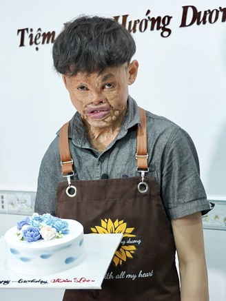 Chàng trai mặt sẹo thành ông chủ tiệm bánh ở TP.HCM để trả ơn đời
