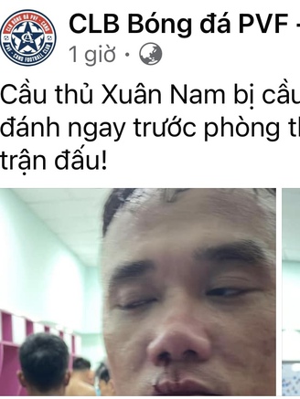 Thực hư vụ Xuân Nam bị đánh đến đổ máu ngay trước phòng thay đồ