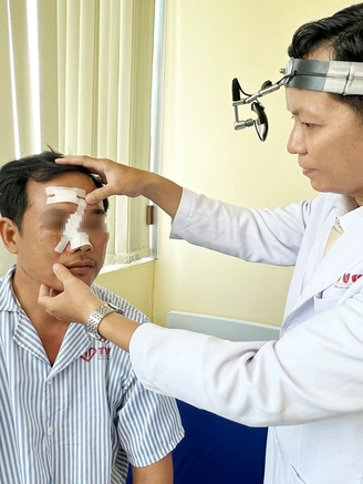 Phát hiện nhiều mảnh kính vỡ nằm sâu trong mũi nam bệnh nhân