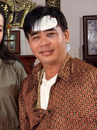 Diễn viên Chánh Thuận bị tai nạn giao thông, gãy xương vai