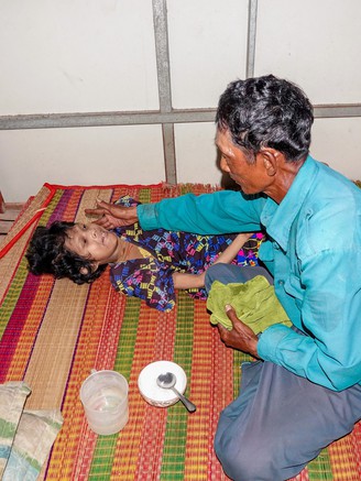 Cha già bán vé số nuôi con bệnh bại não