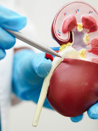 Những dấu hiệu cảnh báo ung thư thận ở trẻ em