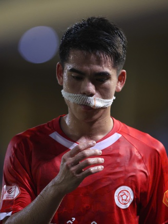 Khuất Văn Khang phải khâu 10 mũi, nhưng vẫn sẵn sàng cho U.23 Việt Nam