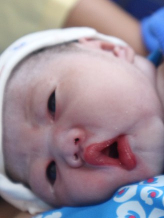 Xúc động khoảnh khắc những 'em bé Bính Ngọ' chào đời đúng giao thừa