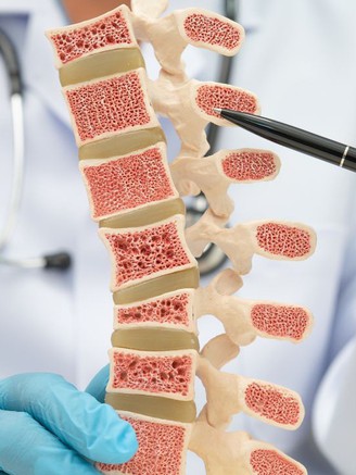 Ăn gì để không bị loãng xương nhanh?