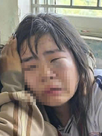 Xử lý nghiêm vụ nữ sinh lớp 7 bị đánh hội đồng trước cổng trường