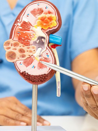 7 thói quen phá hủy thận không phải ai cũng biết