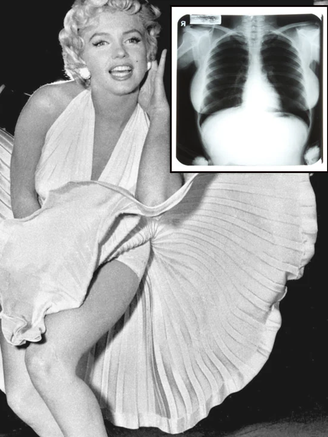 Ảnh X-quang của Marilyn Monroe gây phẫn nộ khi bị đấu giá