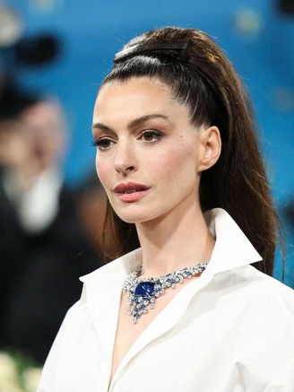 Anne Hathaway gần như bị mù mắt trái suốt 10 năm