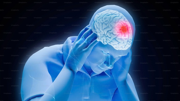 Ngày mới với tin tức sức khỏe: Kê gối cao mới ngủ được, bác sĩ nói gì?- Ảnh 3.