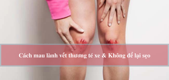 Bị té xe pháo xước chân nên làm những gì nhằm chỗ bị thương nhanh khỏi và ngừa sẹo xấu?- Hình ảnh 3.