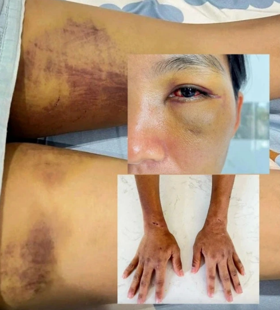 Lâm Đồng: Bắt giữ chồng cũ nạn nhân trong vụ ‘tra tấn em dâu để trừ tà’ - Ảnh 1.