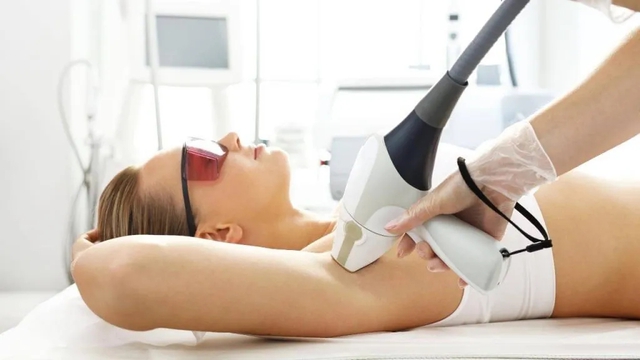 Triệt lông vĩnh viễn - cách thực hiện và kỹ thuật tốt nhất là gì - Ảnh 3. Triệt lông vĩnh viễn - cách thực hiện và kỹ thuật tốt nhất là gì - Ảnh 3.