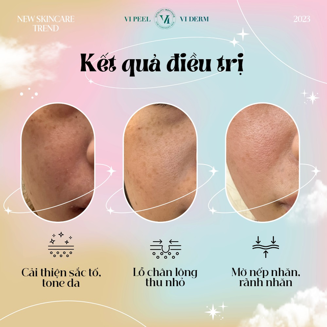 VI Derm: Thương hiệu dược mỹ phẩm dẫn đầu xu hướng chăm da  - Ảnh 6.