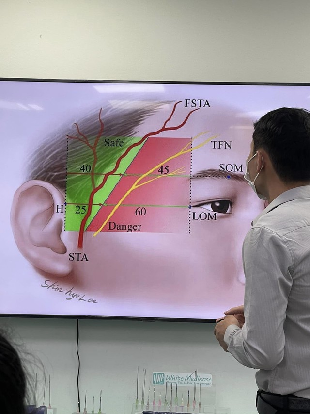 “Tiên dược” botox, những điều bạn cần biết trước khi tiêm botox thẩm mỹ  - Ảnh 4.