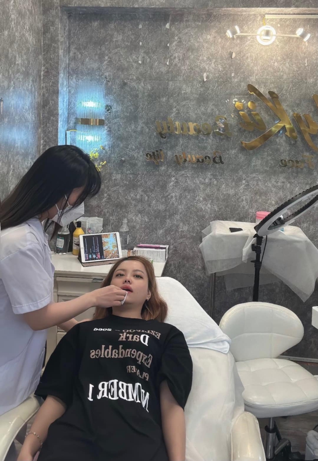 “Tiên dược” botox, những điều bạn cần biết trước khi tiêm botox thẩm mỹ  - Ảnh 6.