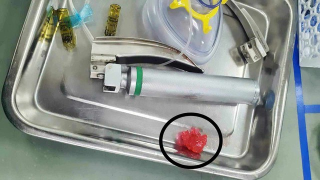 Hải Dương: Bé trai 6 tuổi tử vong do hóc kẹo dẻo - Ảnh 1. Hải Dương: Bé trai 6 tuổi tử vong do hóc kẹo dẻo - Ảnh 1.