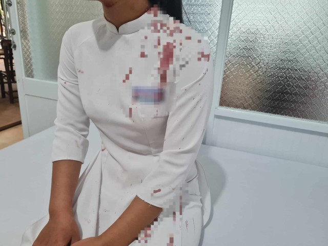 Đắk Lắk: Nữ sinh lớp 10 dùng guốc đánh bạn chảy máu trong giờ ra chơi - Ảnh 1. Đắk Lắk: Nữ sinh lớp 10 dùng guốc đánh bạn chảy máu trong giờ ra chơi - Ảnh 1.