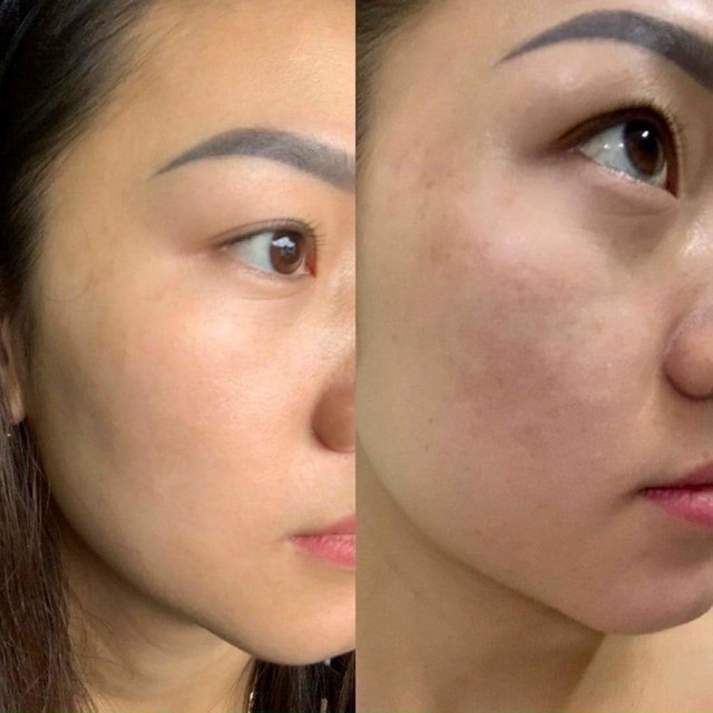 Top 10 serum Retinol làm mờ nếp nhăn chống lão hóa mà không bong tróc, kích ứng - Ảnh 4.