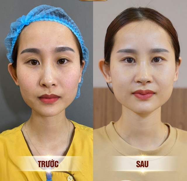 3 dáng môi đang được yêu thích nhất và phương pháp tạo hình cho đôi môi - Ảnh 2. 3 dáng môi đang được yêu thích nhất và phương pháp tạo hình cho đôi môi - Ảnh 2.
