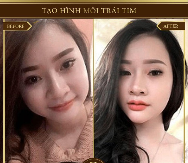 3 dáng môi đang được yêu thích nhất và phương pháp tạo hình cho đôi môi - Ảnh 7. 3 dáng môi đang được yêu thích nhất và phương pháp tạo hình cho đôi môi - Ảnh 7.