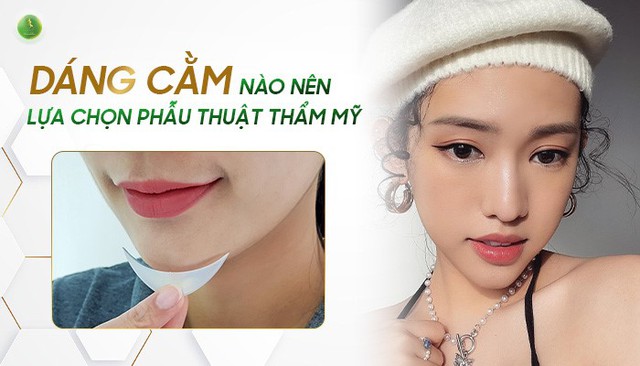 Những dáng cằm thích hợp để thực hiện độn cằm V-Line - Ảnh 1.