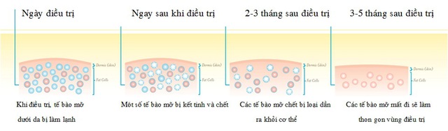 Thon gọn cơ thể bằng phương pháp "đông hủy mỡ" với Coolsculpting - Ảnh 4. Thon gọn cơ thể bằng phương pháp "đông hủy mỡ" với Coolsculpting - Ảnh 4.