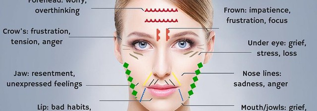 Những vết chân chim ở mắt và điều cần biết khi xóa nếp nhăn bằng Botox - Ảnh 2. Những vết chân chim ở mắt và điều cần biết khi xóa nếp nhăn bằng Botox - Ảnh 2.