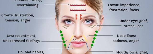 Những vết chân chim ở mắt và điều cần biết khi xóa nếp nhăn bằng Botox - Ảnh 2.